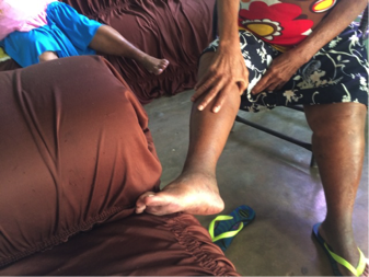 Scheper-hughes Chika Virus