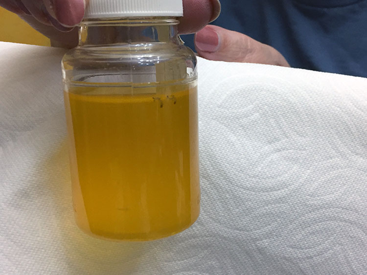A photo of a household water sample directly taken from the tap. Yellow indicates coliform bacterial contamination. 